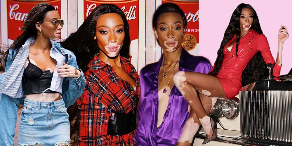 Tampil Fabulous Seperti Model Ternama Winnie Harlow