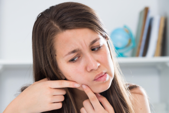 Cara Menghilangkan Komedo Hitam, Kenali Metode yang Tepat