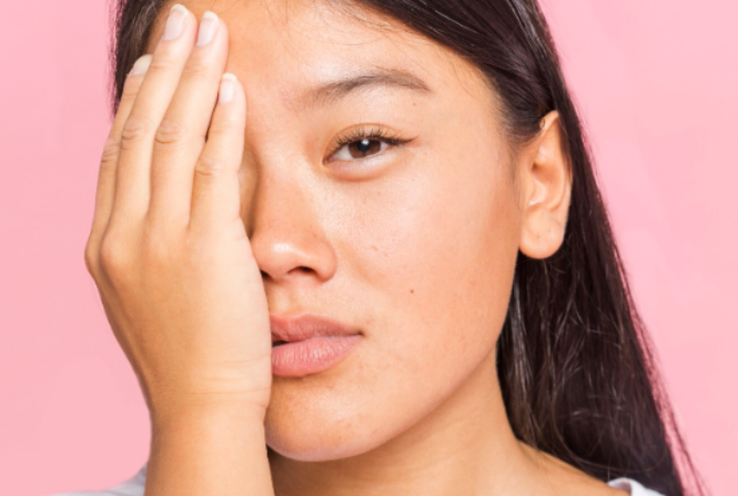 Cara Menghilangkan Mata Sembap, Ini Tipsnya!