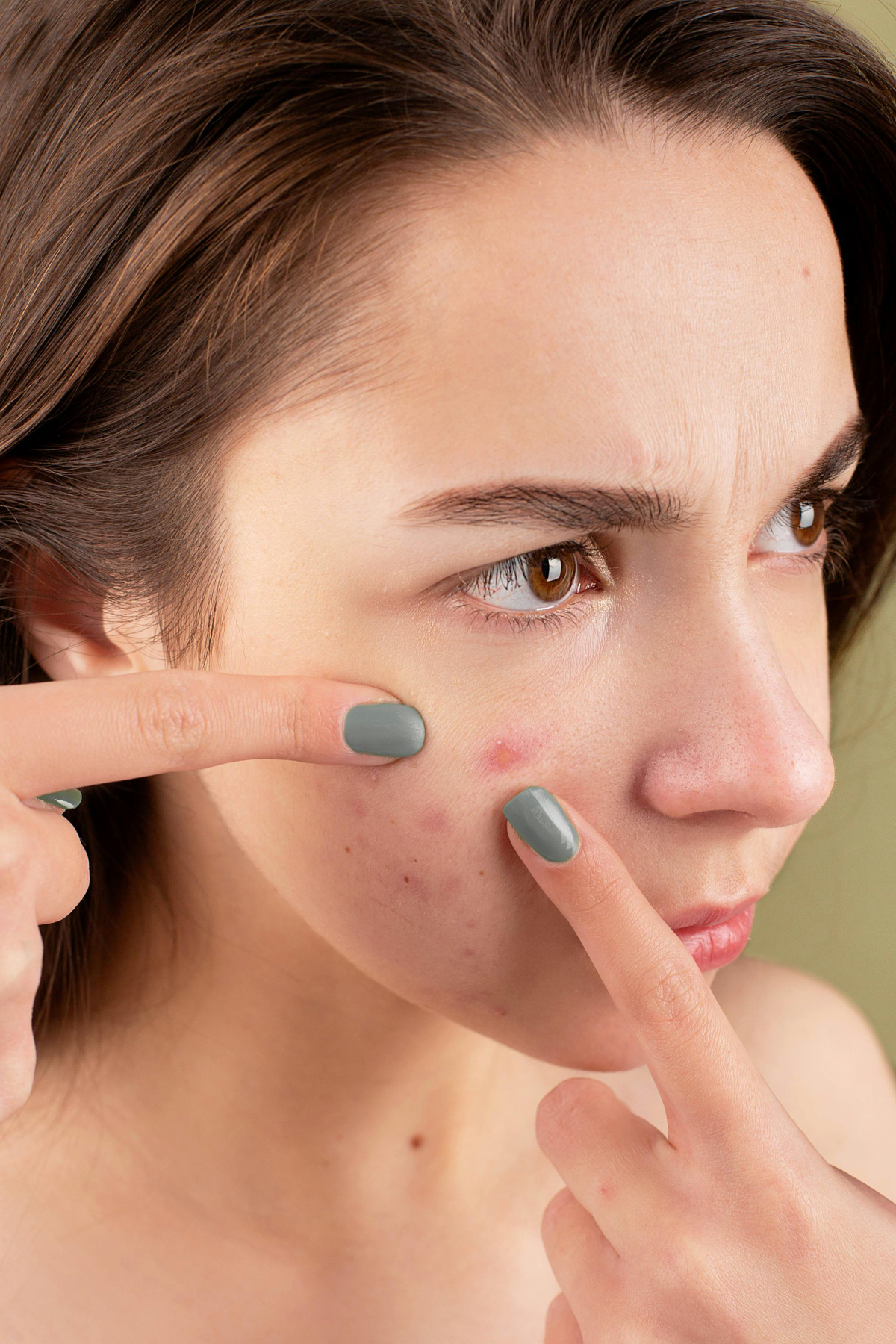 Stop pemakaian skincare jika kulitmu memiliki tanda reaksi buruk ini!