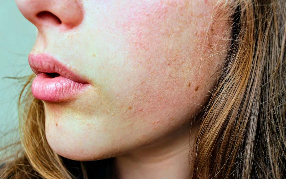 Kandungan Skincare yang Paling Menenangkan Kulit