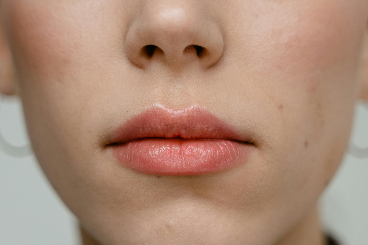 Cara mengatasi jerawat dalam hidung