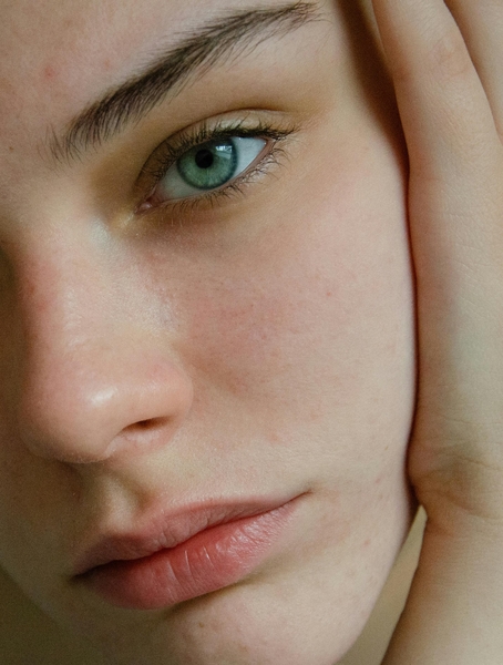 Tidur masih menggunakan makeup bisa memicu ruam