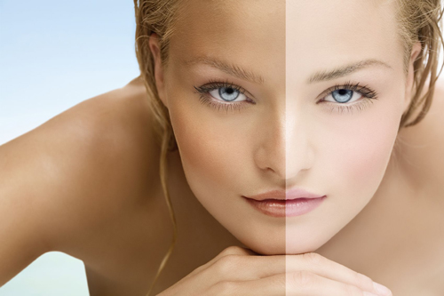 Beauty Q&A: Tip Sebelum Melakukan Whitening Treatment