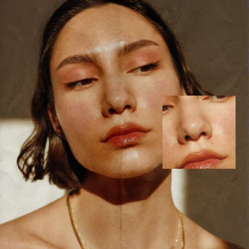Segala Hal yang Perlu Kamu Ketahui Tentang Cara Mengatasi dan Mencegah Munculnya Jerawat di Dalam Hidung