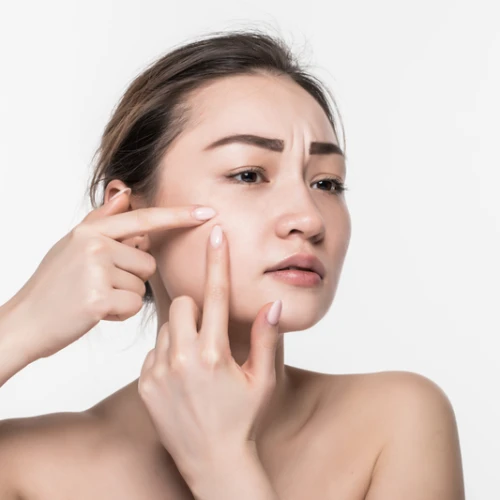 Ketahui Tanda-Tanda Wajah Tidak Cocok Memakai Serum yang Harus Diwaspadai!
