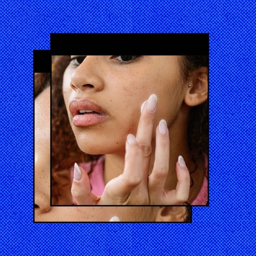 Menurut Dermatologis, Ini Penyebab & Cara Benar Untuk Menghilangkan Blackheads
