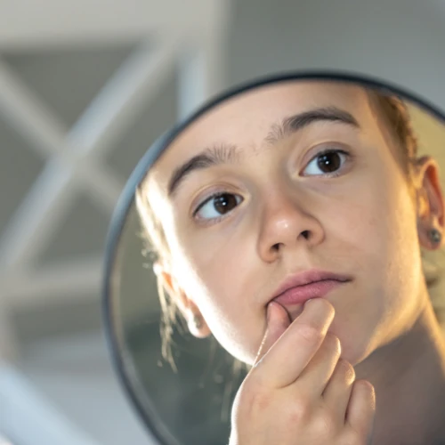 Simak Cara Mengatasi Jerawat Hormonal!