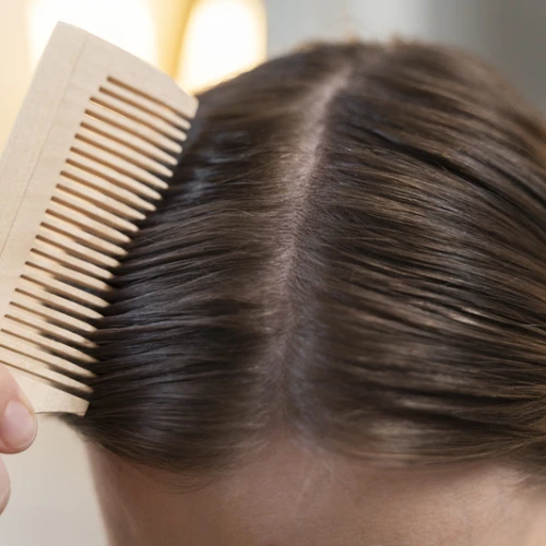 5 Penyebab Rambut Berminyak dan Lepek yang Perlu Kamu Tahu