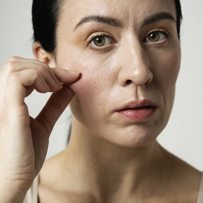 Penyebab Kulit Kendur yang Perlu Diketahui