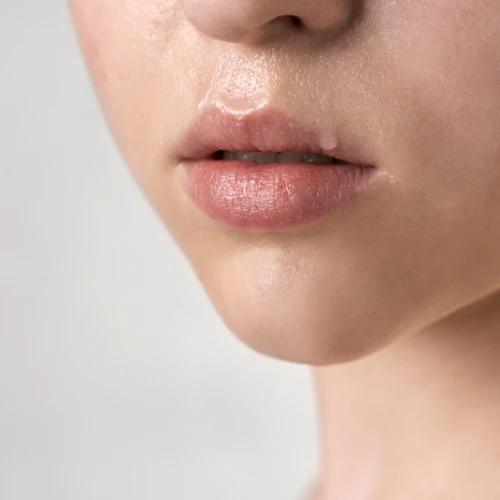 Simak Cara Agar Bibir Tidak Kering Saat Puasa!