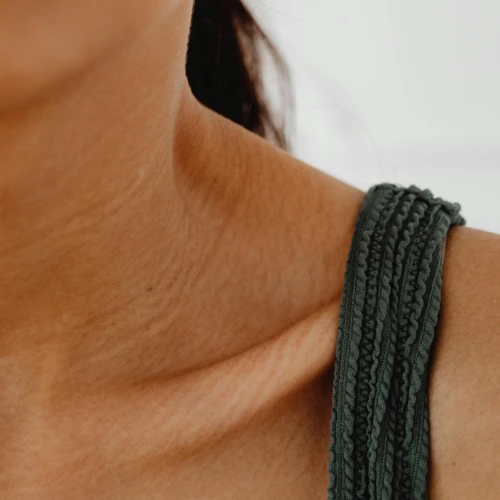 Penyebab Stretch Mark Pada Remaja