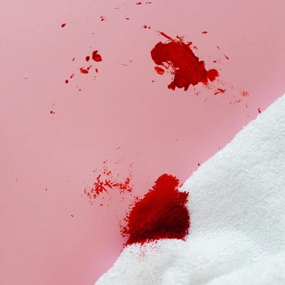 Ketahui 5 Cara Menghilangkan Lipstik di Baju