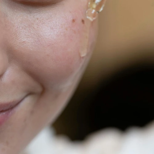 Apakah Salicylic Acid Boleh Dipakai Setiap Hari?