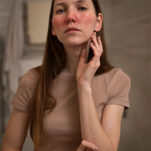 Cara Menghilangkan Kemerahan pada Wajah dengan Cepat