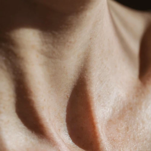 Ketahui Cara Mengatasi Jerawat di Leher