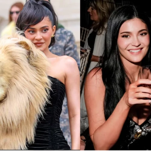 Alasan Kenapa Para Celeb Kini Kompak 'Mencairkan' Filler Mereka