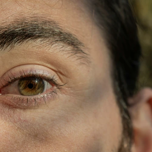 Cara Cepat Meredakan Mata Bintitan