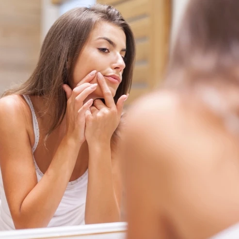Cara Mengatasi Blind Pimple Tanpa Meninggalkan Bekas