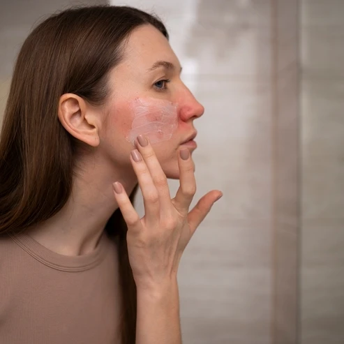 Kenali Efek Samping Over-exfoliation