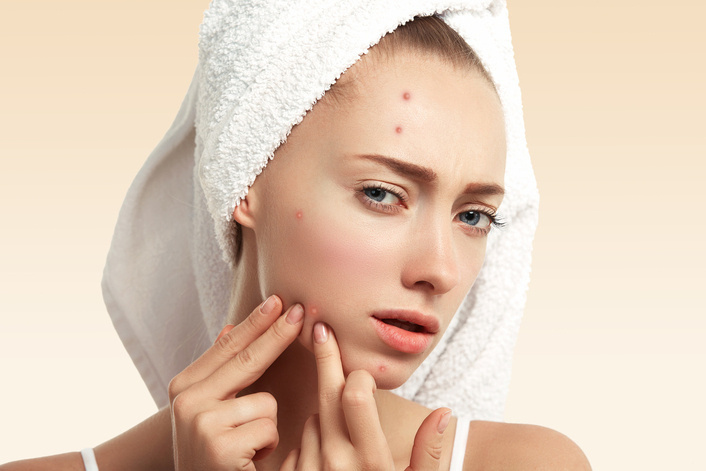 8 Alasan Produk Anti-Acne Kamu Tidak Bekerja Dengan Baik!